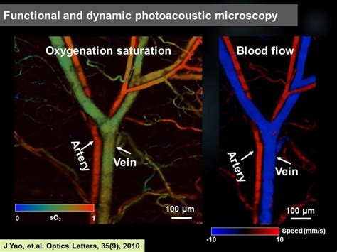 Biomedical applications | Photoacoustic Imaging Lab