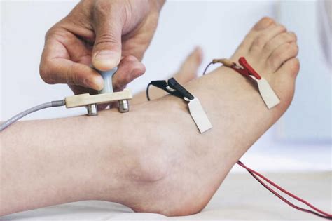 What is nerve conduction velocity Test? | Orthopedics and Pain Medicine ...