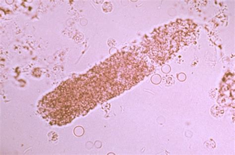 Urinalysis