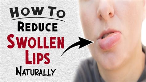 How to Reduce Swollen Lips Naturally | Home Remedies for Swollen Lips ...