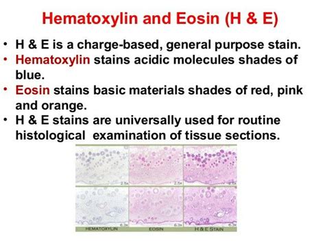 H& E stain _02 | H&e stain, Stain, Microbiology