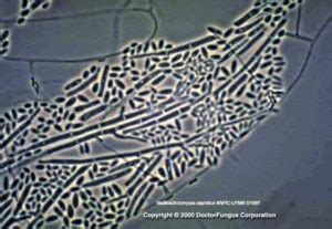 Geotrichum Species - Doctor Fungus