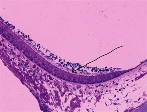 Otolithic Membrane Histology