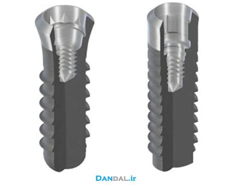 iTi - Straumann Implant - Dandal