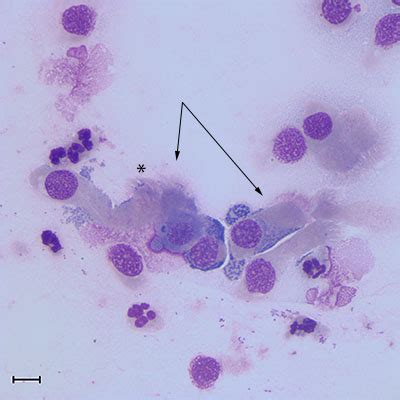 Figure 1a: Ciliated columnar respiratory epithelial cells and ...