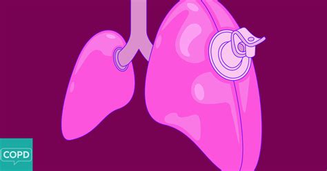 Hyperinflated Lungs and COPD