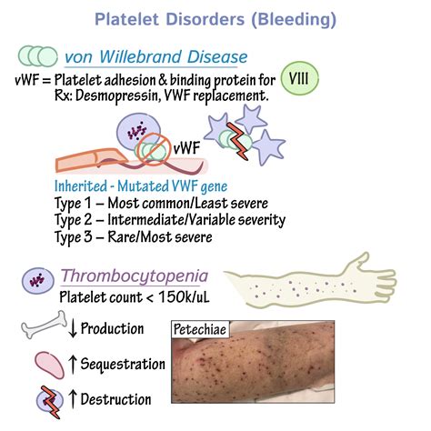 Pathology Glossary: Platelet Disorders | Draw It to Know It