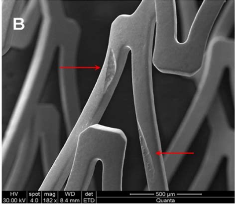 SEM image of typical fretting corrosion damage from [70] | Download ...