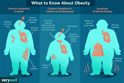 Obesity Symptoms for Adults and Children