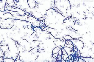 Bacillus anthracis , Gram (+) Slide | Ward's Science