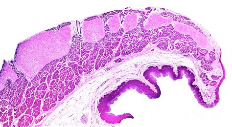 Epiglottis Histology Labeled