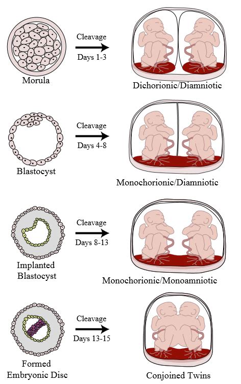 Multiple Gestation: biology and epidemiology | GLOWM