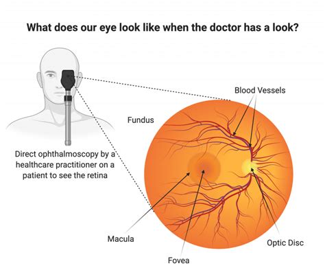 The retina and retinal pigment epithelium (RPE) | UCL Institute of Ophthalmology - UCL ...