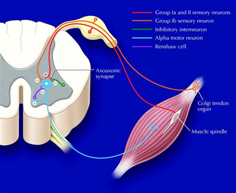 Rehabilitation medicine: 3. Management of adult spasticity | CMAJ