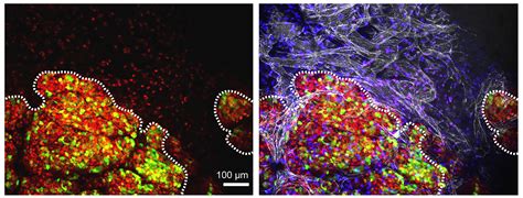 A master switch controls aggressive breast cancer - Salk Institute for ...