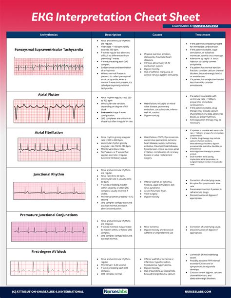 EKG Interpretation Cheat Sheet & Heart Arrhythmias Guide (2020 Update)