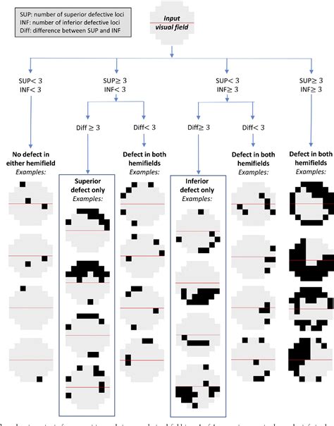 Figure 1 from Patterns of Binocular Visual Field Loss Derived from Large-Scale Patient Data from ...