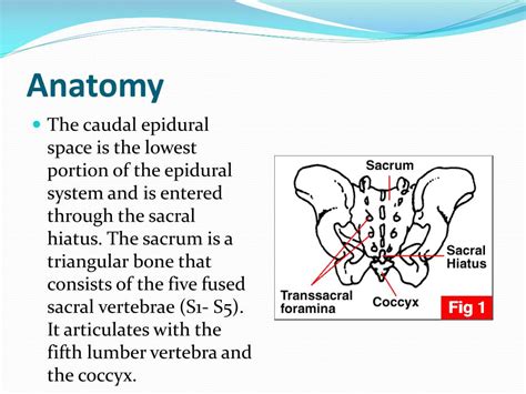 PPT - CAUDAL ANESTHESIA PowerPoint Presentation, free download - ID:755679