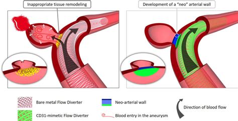 CD31 Mimetic Coating Enhances Flow Diverting Stent Integration – LVTS ...