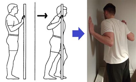 🤲 Click Physiotherapy: SUBACROMIAL OR ROTATOR CUFF IMPINGEMENT: EXERCISES