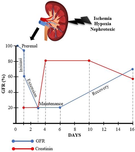 The relationship between GFR and serum creatinine (SCr) in the AKI ...