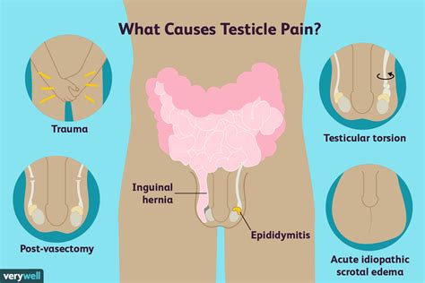 Pain In Right Testicle After Exercise – Online degrees