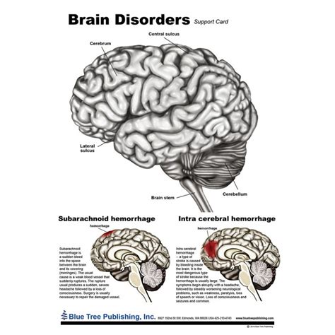 Brain Disorders Anatomical Chart