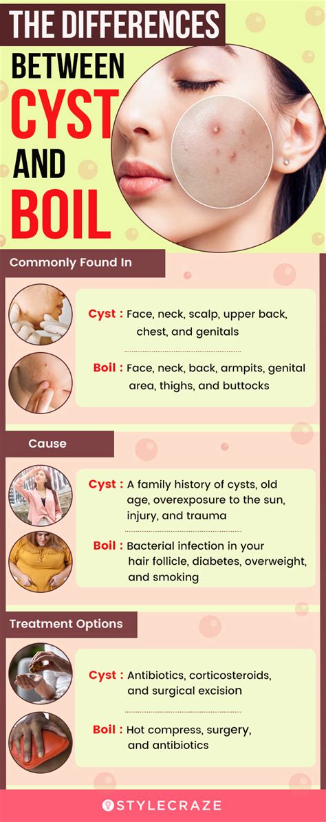 Boil Cyst: Telling The Difference Understanding Prevention