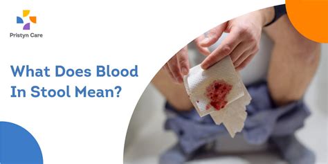 What Does Blood In Stool Mean? - Pristyn Care