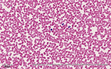 Blood Smear Histology Labeled