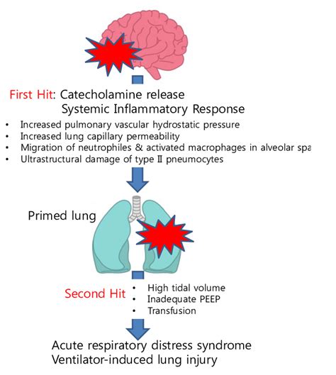 Pathophysiology of lung injuries in patients with brain injury: the... | Download Scientific Diagram