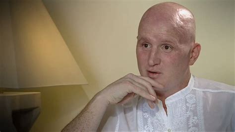 John Hartson's cancer battle - YouTube