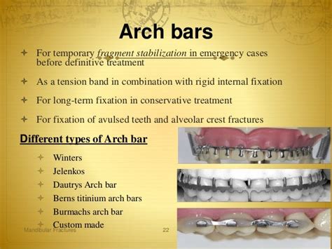 Mandible # brief