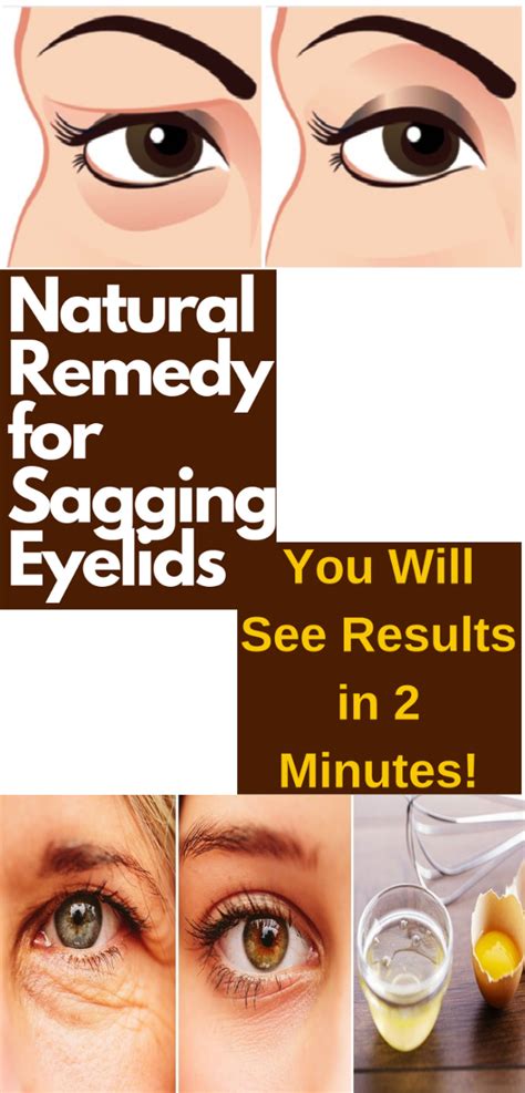 Natural Remedy for Sagging Eyelids – You Will See Results in 2 Minutes! - healhty and tips