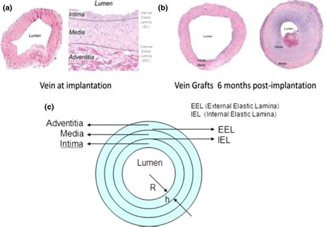 Vein graft histology and anatomy histological measurements conducted ...