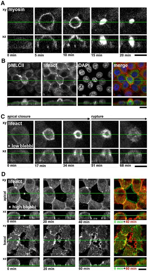 Myosin activity is required for rosette formation, apical contraction... | Download Scientific ...