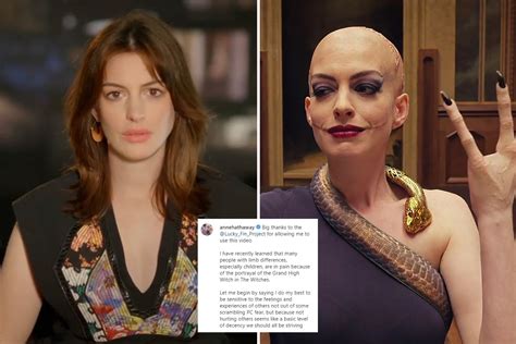 Anne Hathaway apologizes for ‘causing pain’ to disabled people after playing villain with split ...