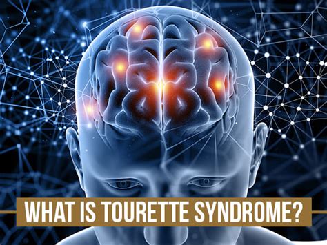 World Disability Day 2022: Tourette Syndrome Causes, Symptoms ...