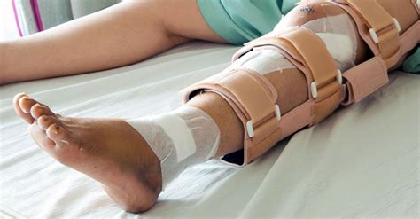 Why You Should Never Put Your Feet On The Dashboard - Personal Injury ...