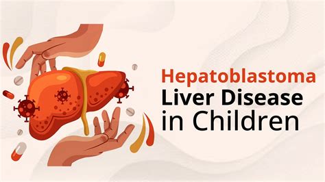 Hepatoblastoma | A Rare Paediatric Liver Disease