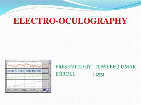 Electrooculography