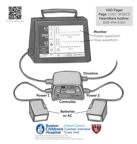 Heartware Lvad