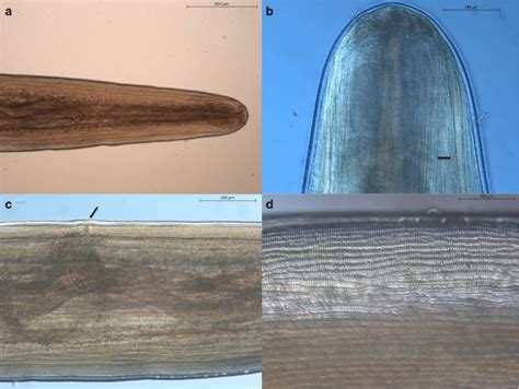 Dirofilaria repens female observed at light microscopy. a Lateral view... | Download Scientific ...