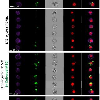 Single cell imaging of PBMC's capacity to engulf fluorescent bacteria.... | Download Scientific ...