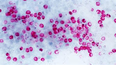 Cryptosporidium - Causes, Symptoms, Diagnosis, Prevention & Treatment