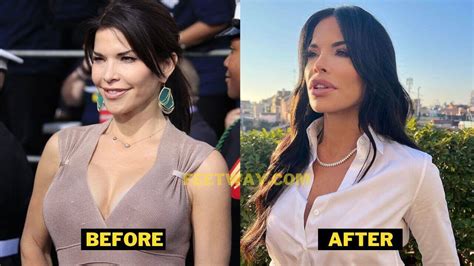 Lauren Sanchez Plastic Surgery. Jeff Bezos's Girlfriend's Before-After ...