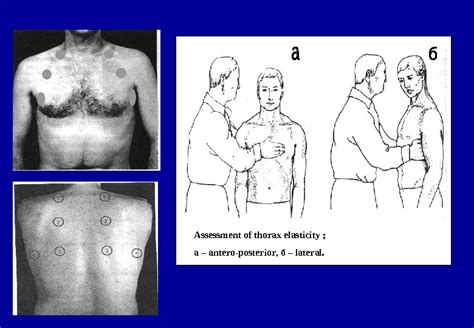 Percussion of the lungs Palpation of the chest