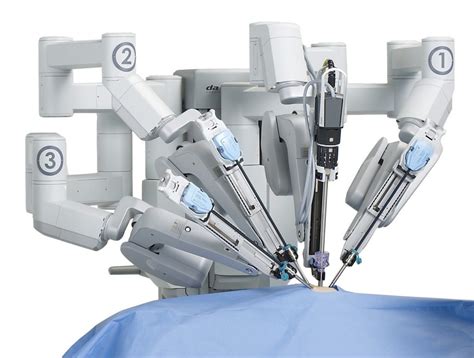 The Robot Assisted Surgery for Epilepsy that Changed on Man’s Life | SurgeryFix