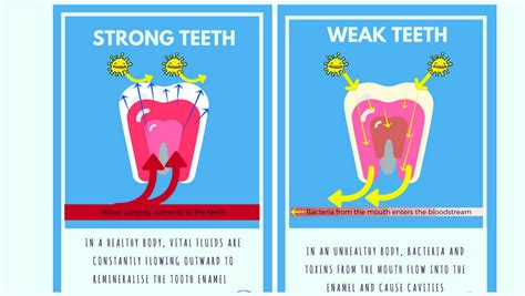 How Long Does Remineralization Of Teeth Take - Teeth Poster