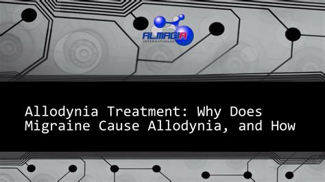 PPT - Allodynia Treatment Why Does Migraine Cause Allodynia, and How PowerPoint Presentation ...